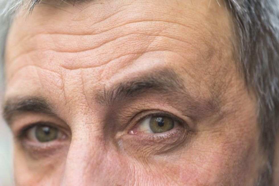 What Your Facial Wrinkles May Be Trying to Tell You 2 1