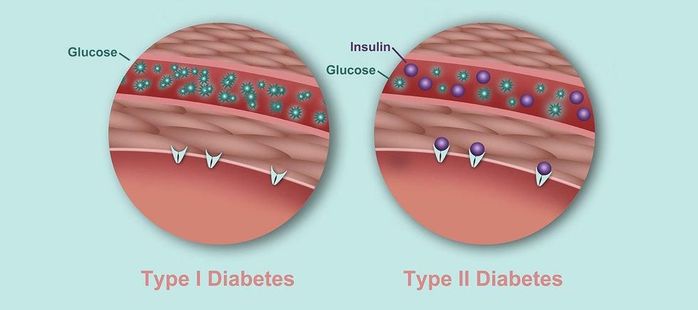whats the difference between