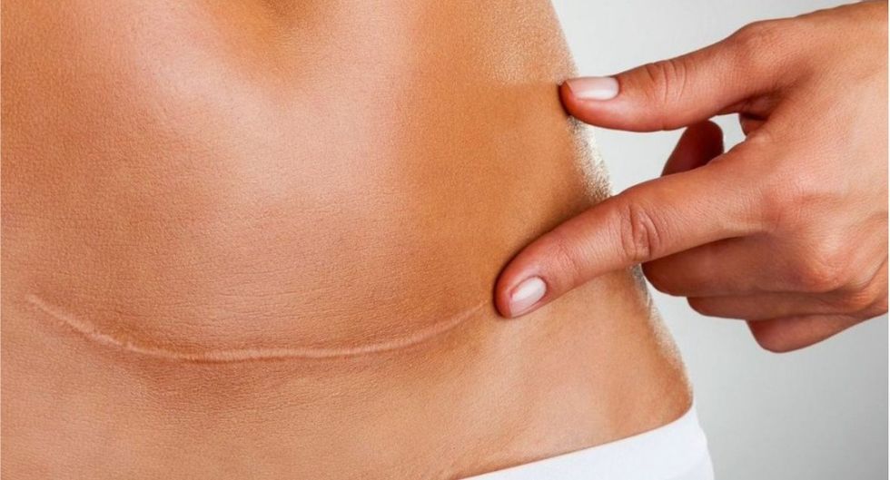 whatsapp image 2017 07 03 at 20 10 57