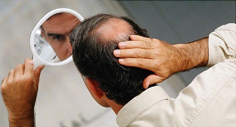 why am i losing my hair ref guide