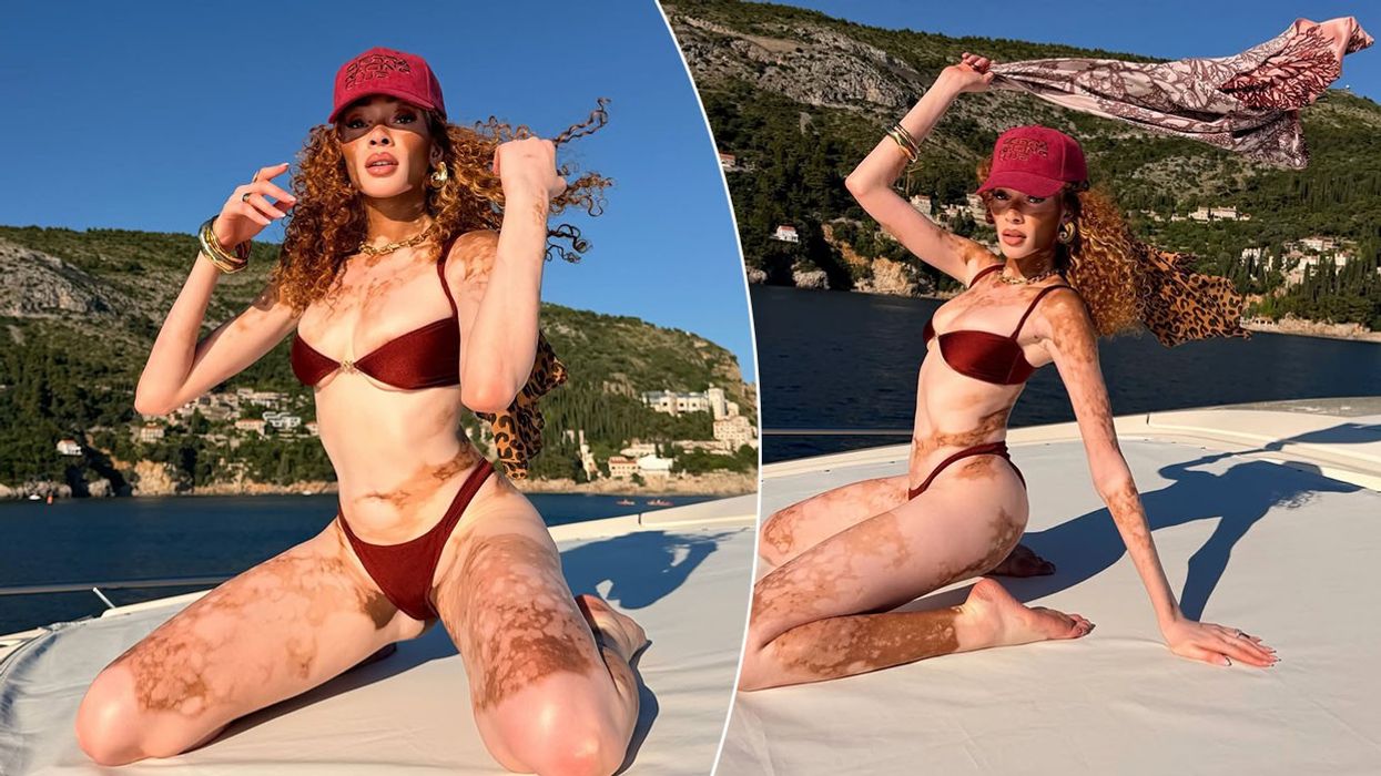 Modelja e famshme Winnie Harlow me pushime në Dubrovnik, tregon me krenari linjat trupore dhe lëkurën e saj unike Modelja e famshme Winnie Harlow me pushime në Dubrovnik, tregon me krenari linjat trupore dhe lëkurën e saj unike
