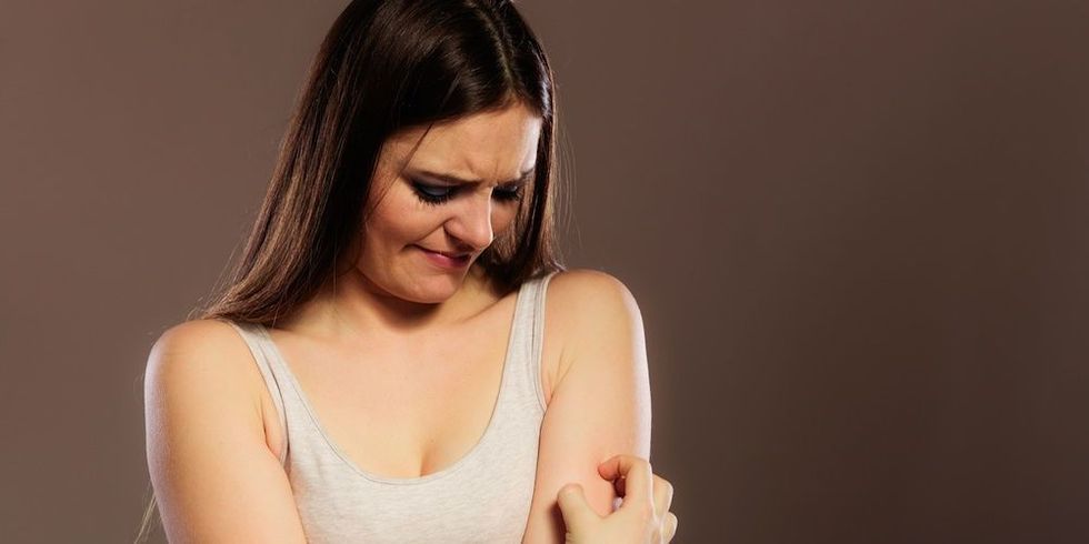 woman itchy skin 1487212658