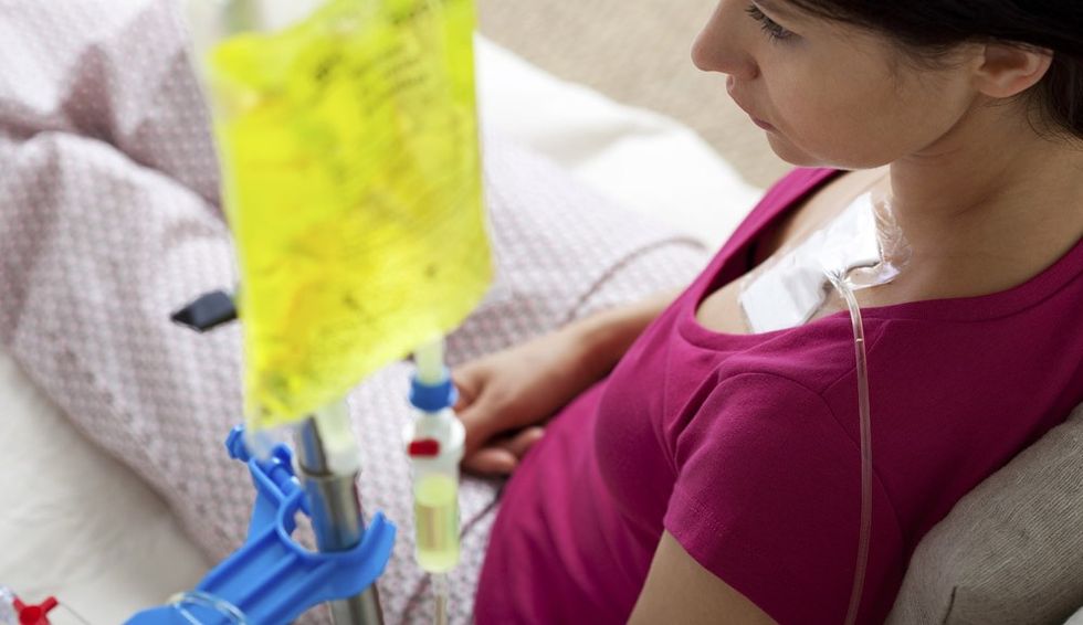 woman undergoing chemotherapy for breast cancer