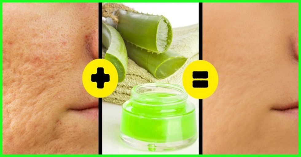 Wonderful Benefits Of Aloe Vera Juice