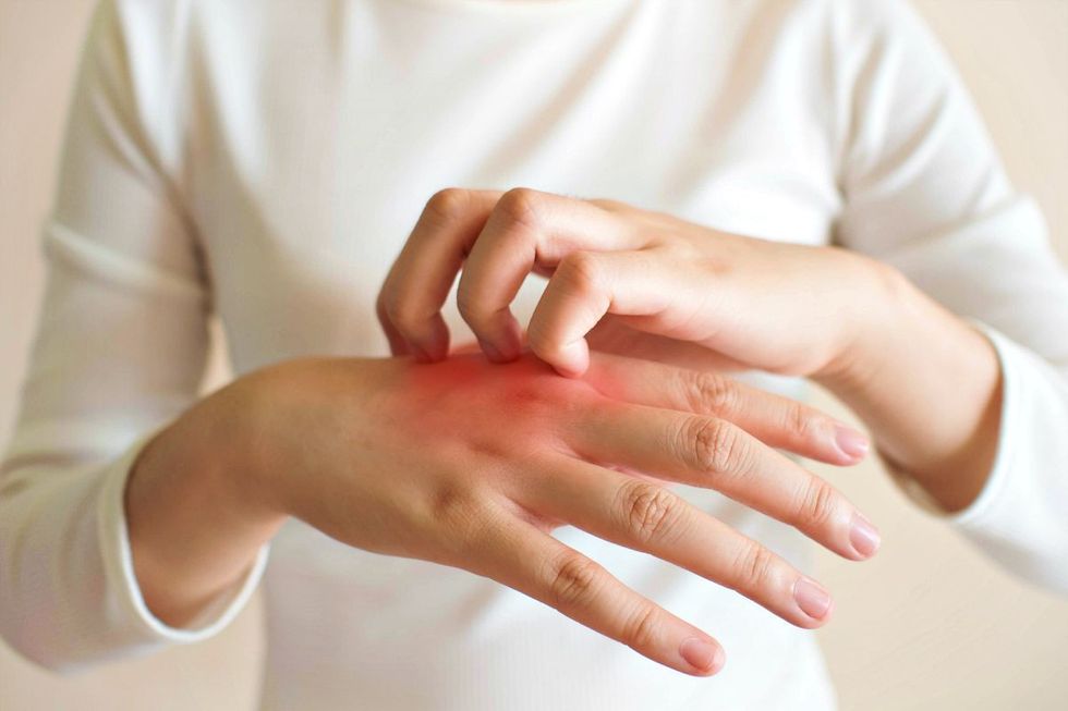 young woman scratching itch on her signs of skin cancer ss