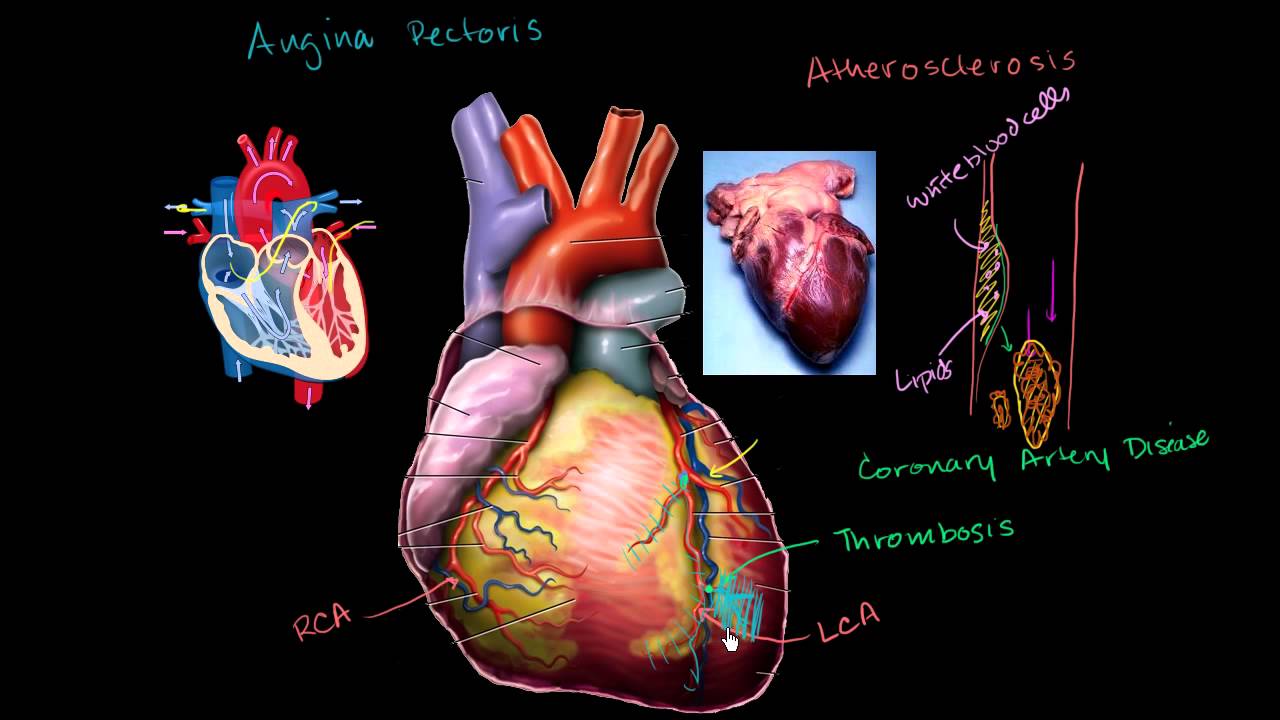 Sa i njihni sëmundjet e zemrës?