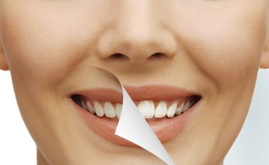Cilat janë efektet anësore të zbardhjes së dhëmbëve?