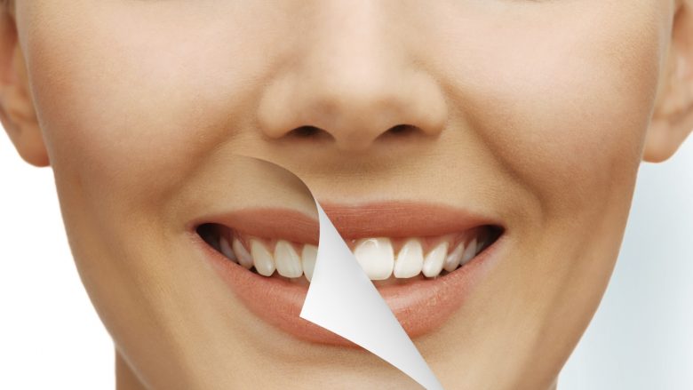 Cilat janë efektet anësore të zbardhjes së dhëmbëve?