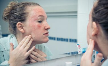Si t’i shmangemi alergjive të kozmetikës