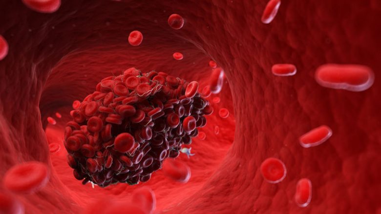 Ku qëndron lidhja midis hekurit, hemoglobinës dhe rruazave të gjakut