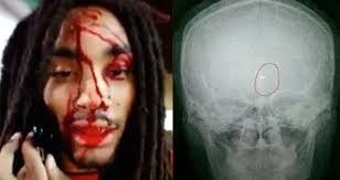 The American rapper is shot with a cane (Video) - Telegrafi - Telegrafi