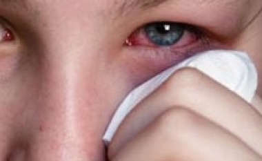 Shmangia e infeksioneve në sy