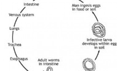 Icterus e obstructionem, Cholelithiasis, Choledocholithiasis, Ascariasis ductus choledochi