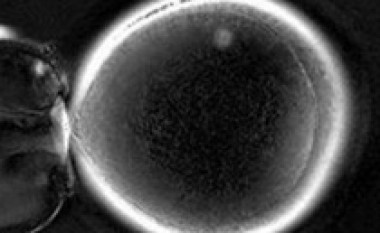Shkencëtarët kanë krijuar embrionin e parë të klonuar
