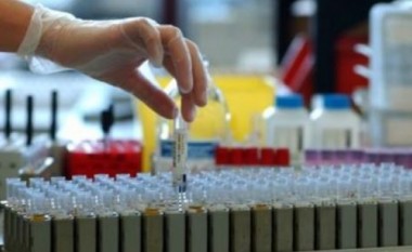 Shqipëri: Laboratorët privatë kanë 4-fishuar fitimet gjatë pandemisë së COVID-19