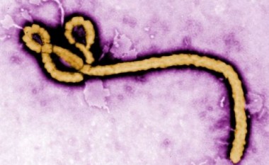 OBSH: Virusi Ebola nuk është emergjencë ndërkombëtare