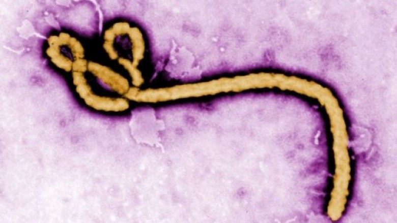 OBSH: Virusi Ebola nuk është emergjencë ndërkombëtare