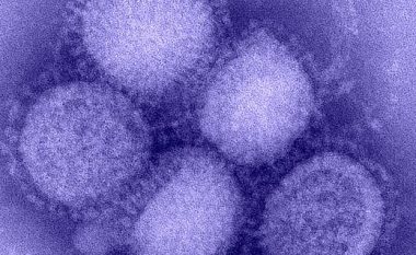 Në Kosovë rikthehet “gripi i derrit”
