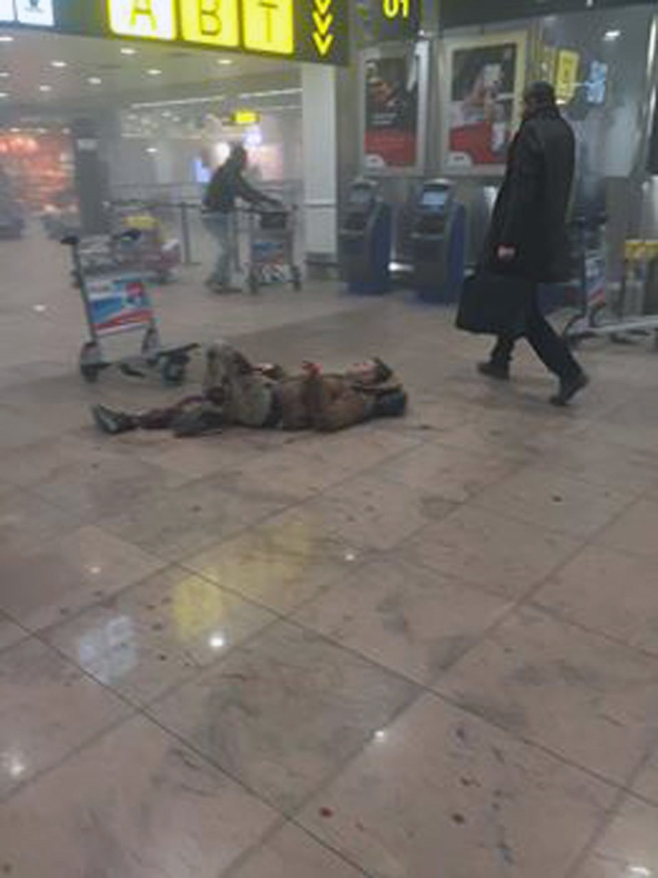 In this photo provided by Georgian Public Broadcaster and photographed by Ketevan Kardava a man is wounded in Brussels Airport in Brussels, Belgium, after explosions were heard Tuesday, March 22, 2016. A developing situation left at least one person and possibly more dead in explosions that ripped through the departure hall at Brussels airport Tuesday, police said. All flights were canceled, arriving planes were being diverted and Belgium's terror alert level was raised to maximum, officials said. (Ketevan Kardava/ Georgian Public Broadcaster via AP)