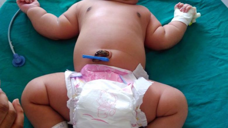Lind foshnja më e rëndë në botë (Foto/Video)
