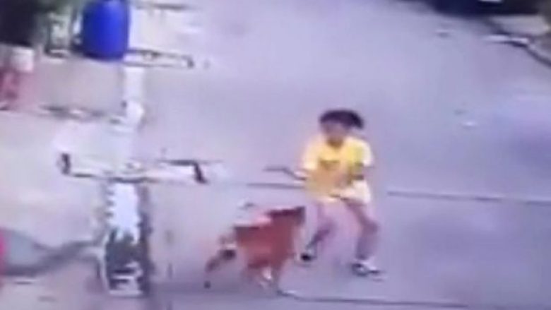 Momenti kur qeni sulmon 14-vjeçaren, të cilës i shkakton 100 qepje në fytyrë nga kafshimet (Foto/Video, +16)