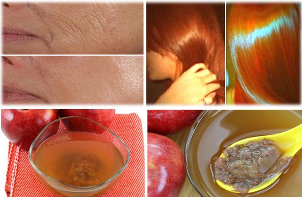 22-Best-Health-and-Beauty-Uses-of-Apple-Cider-Vinegar