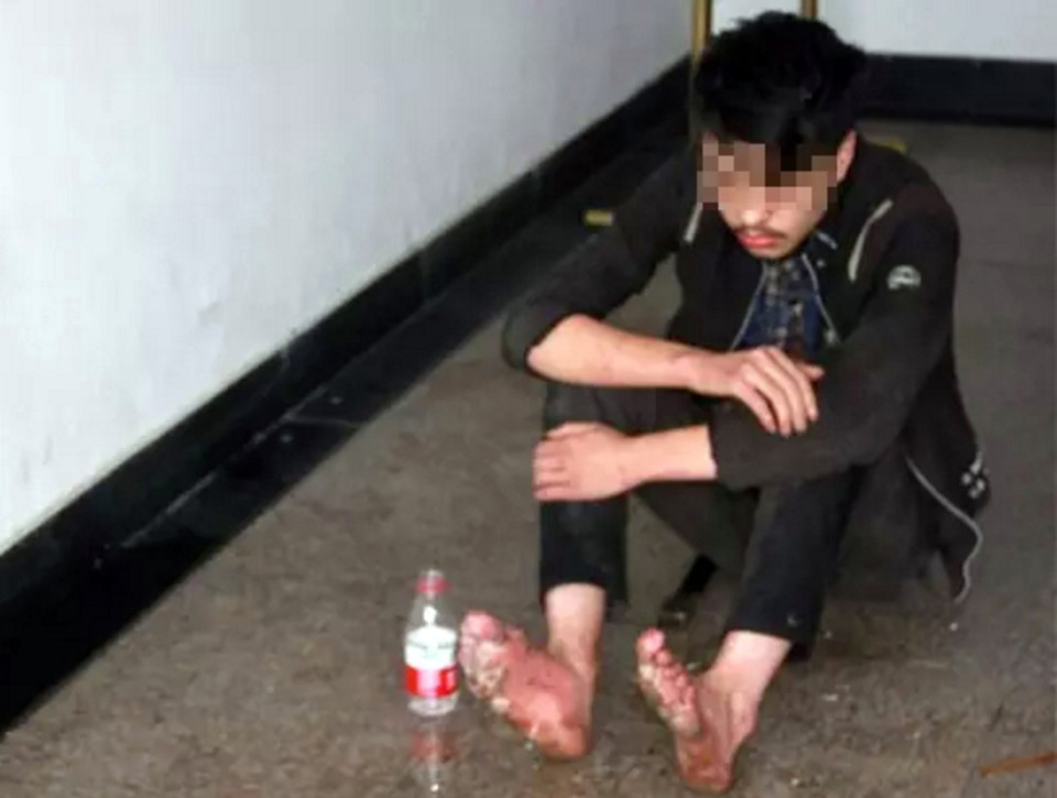 Pic shows. The gamer in a police station. Police rescued a teenager who was so addicted to online gaming he let his feet rot when he went on a six-day binge at an internet cafe and forgot to wash or feed himself and later collapsed. The unnamed man, aged 19, had apparently run away from home in order to go on the bizarre and dangerous gaming adventure, with his own father even reluctant to take him home. Authorities in Hangzhou, capital of East Chinas Zhejiang Province, reportedly came across the young gamer after he was spotted lying unconscious behind the shrubs of a railway track. He was found with bleeding and infected feet, which had festered and which let off a putrid smell. The man only woke briefly to ask for water as he was dragged back to the police station for some basic medical attention. He told authorities that he had not eaten for three days, having spent all his money on a six-day, non-stop gaming spree at the internet cafe. It was clear that he had not taken a shower during the time either, which is thought to be the main contributing factor to his rotting feet. Reports said the gamers own father initially told officer that he did not want his son back, claiming that the teenager ran away from home 10 days ago and did not care for anything else besides online gaming. But after some consideration the dad asked for his son to be sent back to him. Officers said they were concerned for the young man because his foot infection could have killed him if he had not been found in time. (ends)