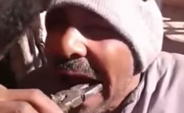 Kështu nxirret dhëmbi në Egjipt: ‘Dentisti’ masakrues  (Video)