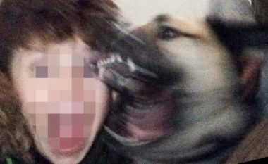 Qeni e kafshoi në fytyrë, derisa po bënte ‘selfie’ (Foto, +16)
