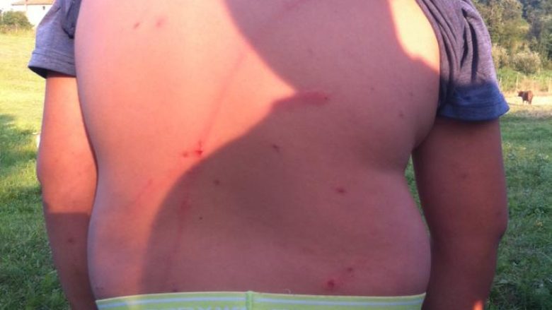 Veterani i UÇK-së: Pjesëtari i FSK-së ma rrahu djalin 14 vjeç (Foto)