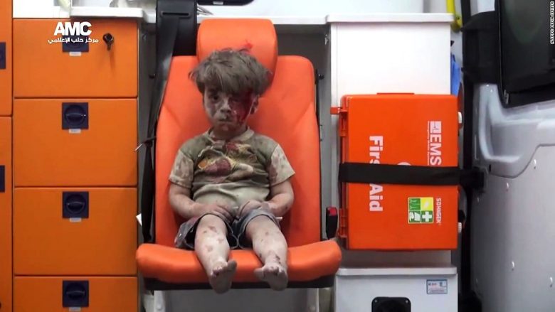 Doktorët për djalin e lënduar sirian: Pavarësisht lëndimeve, ai nuk ka qarë (Video)