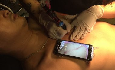 Bëri tatuazh për të mbështetur të birin, që i ka mbetur një ‘shenjë të shëmtuar’ pas operimit (Foto)