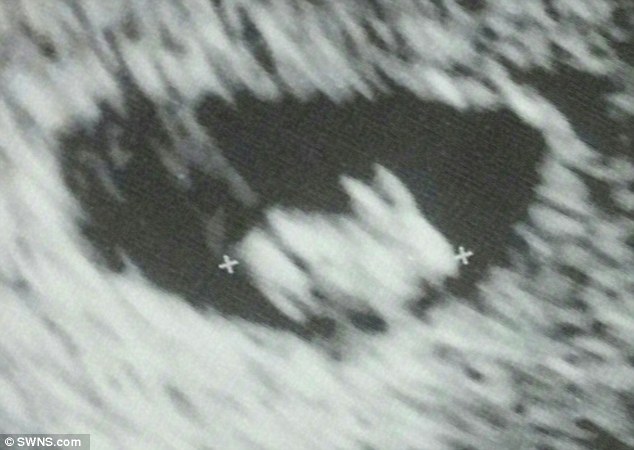 Fotografia bizare e ultrazërit qe e shfaqe nje lepur ne vend te femijes foto 3