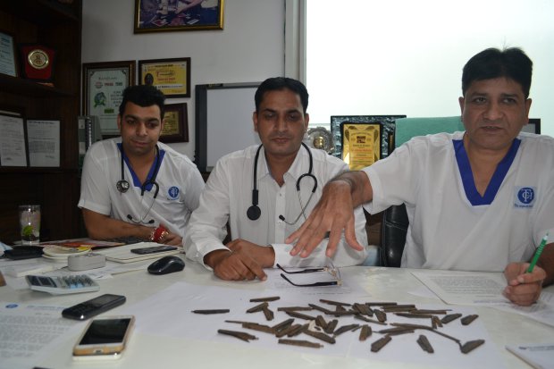 *** CORRECTION: BYLINE UPDATED *** GURDASPUR, INDIA - AUGUST 19: Team of Surgeons, Physicians and Critical Care Physicians seen operating patient, Jarnail Singh on August 19, 2016 in Gurdaspur, Punjab. AN INDIAN man has received emergency treatment after swallowing 40 metal knives. 42-year-old Jarnail Singh was admitted to The Corporate Hospital in Gurdaspur, India, a few days ago with complaints of abdomen pain and weakness. A team of surgeons were astonished when they discovered he had swallowed not one, not two, but 40 knives over the last two months because he liked the way they tasted. After five hours of surgery, Jarnail was successfully treated and will be discharged in the upcoming days. PHOTOGRAPH BY Dinesh Dubey / Barcroft Images London-T:+44 207 033 1031 E:hello@barcroftmedia.com - New York-T:+1 212 796 2458 E:hello@barcroftusa.com - New Delhi-T:+91 11 4053 2429 E:hello@barcroftindia.com www.barcroftimages.com