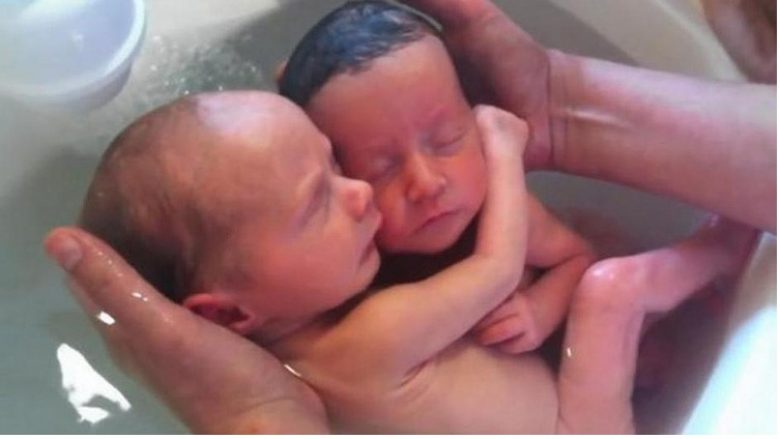 Momenti i bukur kur binjakët e porsalindur mendojnë se janë ende në mitër (Video)