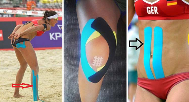 Why-Olympic-athletes-wear-that-weird-tape