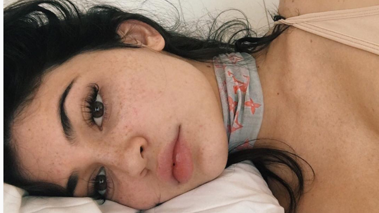 Kylie Jenner heq grimin: Ja çfarë ka fshehur për vite me radhë!