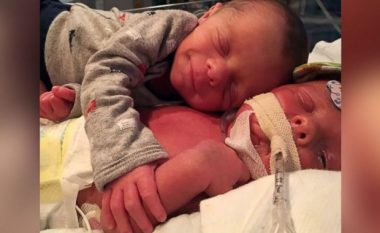 Fotoja që emocionoi botën: Përqafimi i foshnjave binjake, por njëri nuk mbijetoi (Foto)