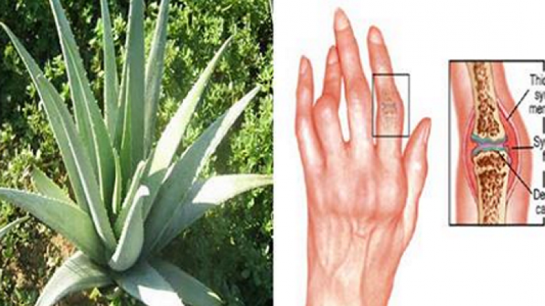 Këto janë bimët dhe vajrat natyral që e luftojnë dhe shërojnë artritin
