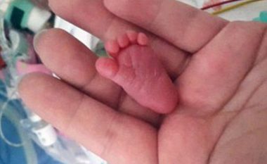 Mbijeton bebja e lindur me vetëm 230 gramë (Foto)