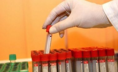 Shkencëtarët afër gjetjes së ilaçit të HIV-it, pritet konfirmimi
