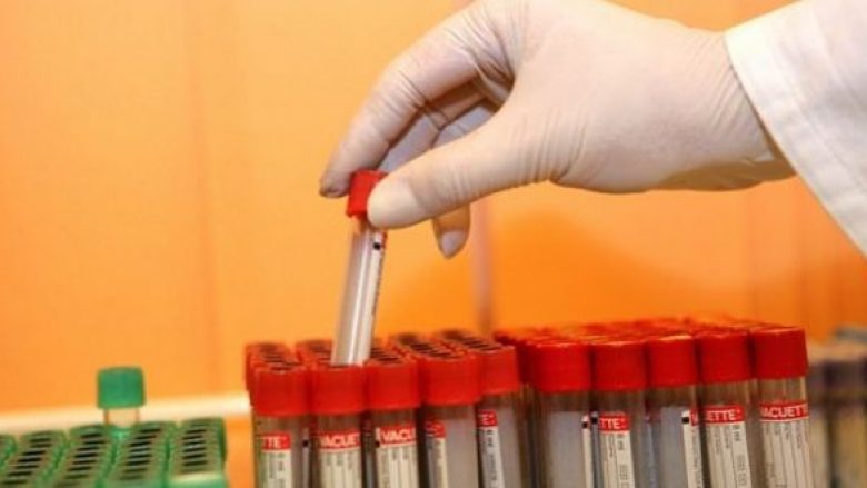 Shkencëtarët afër gjetjes së ilaçit të HIV-it, pritet konfirmimi