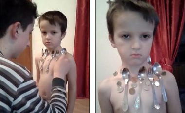 Njeriu magnet nga Bosnja: Shikoni se si në trupin e këtij djaloshi ngjiten luga, piruni gjësende tjera nga metali (Foto/Video)