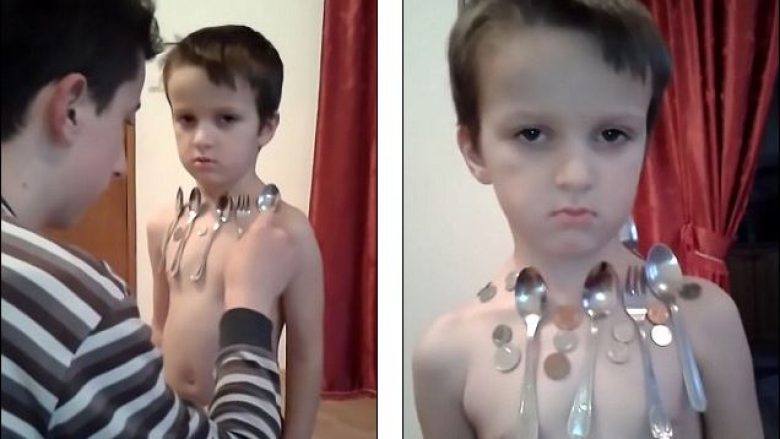 Njeriu magnet nga Bosnja: Shikoni se si në trupin e këtij djaloshi ngjiten luga, piruni gjësende tjera nga metali (Foto/Video)
