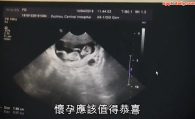 Skandaloze: Fati i tmerrshëm i 12-vjeçares shtatzënë, që jeton me një 40-vjeçar në Kinë! (Foto)