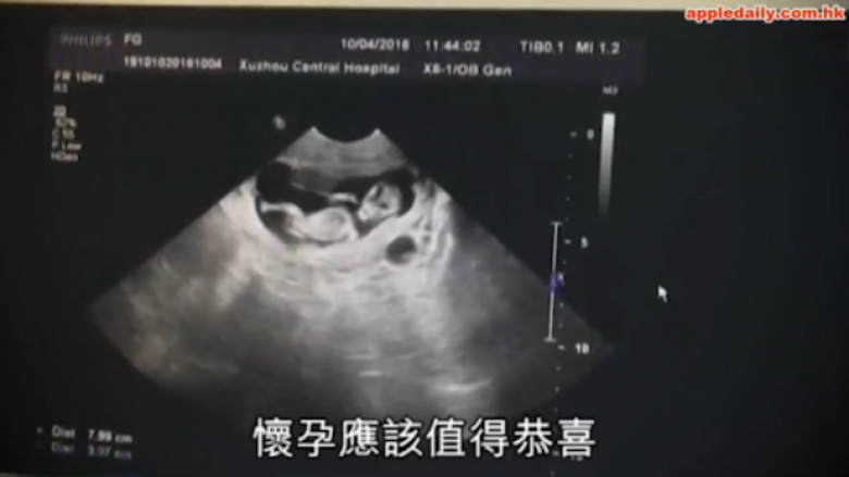 Skandaloze: Fati i tmerrshëm i 12-vjeçares shtatzënë, që jeton me një 40-vjeçar në Kinë! (Foto)