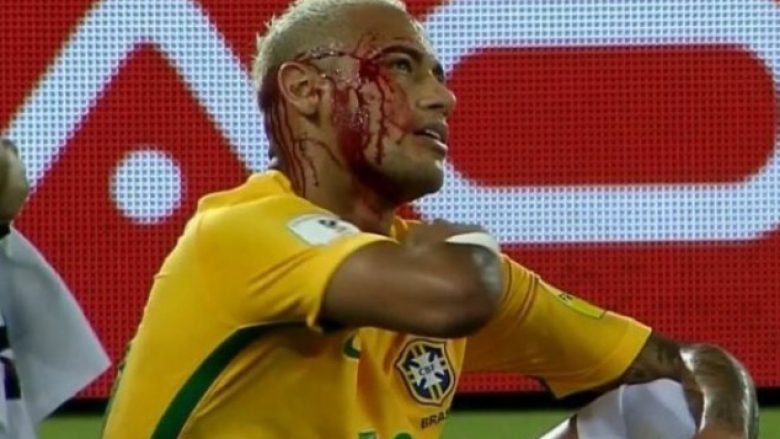Gjakoset Neymar në ditën kur po bënte histori me Brazilin (Video)