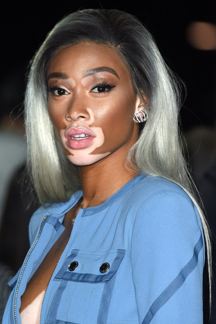 Winnie Harlow – Chantelle Brown-Young