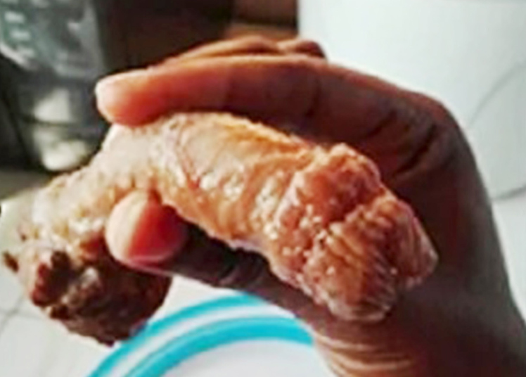 Pic shows: The served meat with the appearance of a male genital organ.nnAstonishing images of what looks like a human penis served up at a fast food bar have become a social media mystery.nnThe manhood-like dish had been unwittingly bought from a traditional chop house in Accra, Ghana by a customer named only as Akosua in local media.nnBut it was only when she got it home and started eating the dish - a local delicacy called Tuo Zafi ¿ that she realised she had bitten off more than she could chew.nnAkousa told local media: "I had gone to get some food from the food joint because I was hungry and my preferred choice was Tuo zafi which I bought and took home to eat."nnBut she did not spot the penis-shaped meat until she had gobbled down about 70 percent of the dish, she said.nnInitial tests at a laboratory proved inconclusive, explained Akosua, who was then urged to hand the meat to police for a full forensic examination.nnShe said: "My sister opted to show it to a lab technician friend later, who said because the meat was cooked, an ordinary lab test wouldn¿t be able to prove it to be animal or human."nnAkousa added: "He advised a forensic test be done on it and the meat lies in our fridge."nn(ends)