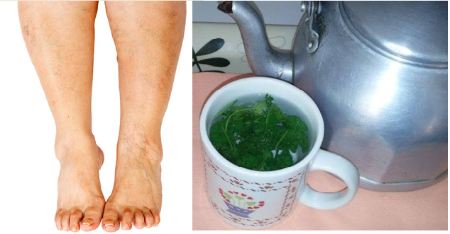 relieve-quickly-and-naturally-the-unpleasant-feeling-of-swollen-legs-with-this-powerful-tea